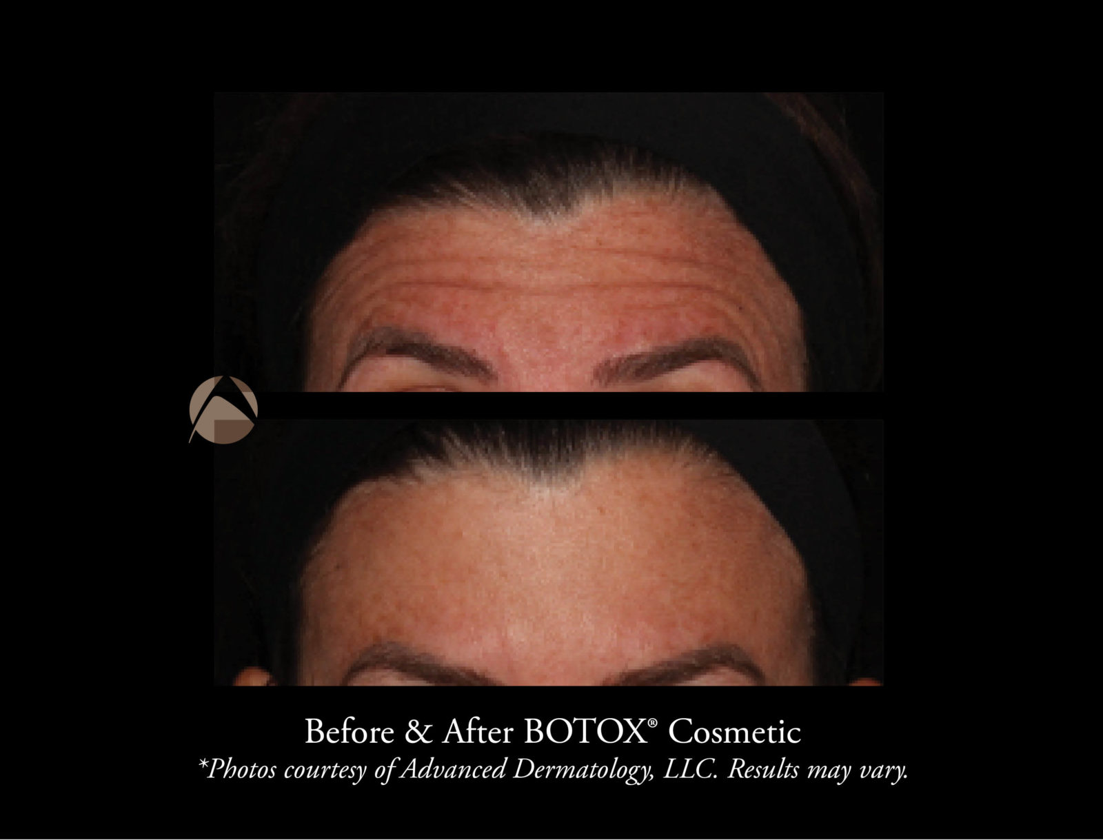 Before & After Photos | Advanced Dermatology